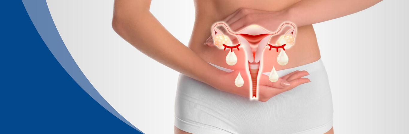 &iquest;Qu&eacute; es la candidiasis vaginal y c&oacute;mo prevenirla?